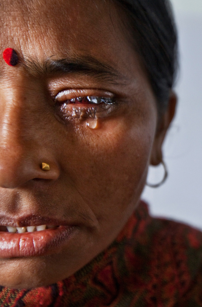 Sabitri Lamichhane has a severe eye infection, in order to save her vision she is to undergo a cornea transplant procedure. Her infected cornea will be removed and replaced with one that was donated. In Kathmandu, Nepal. 2010