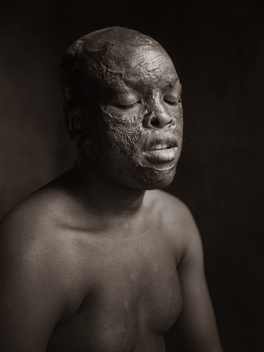 The 2026 Black and White Portraits Lenscratch Exhibition