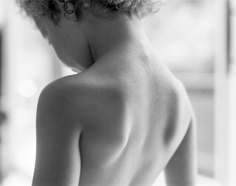 Photograph of child's shoulders